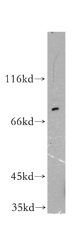 SGC-7901 cells were subjected to SDS PAGE followed by western blot with Catalog No:111175(GSPT1 antibody) at dilution of 1:100