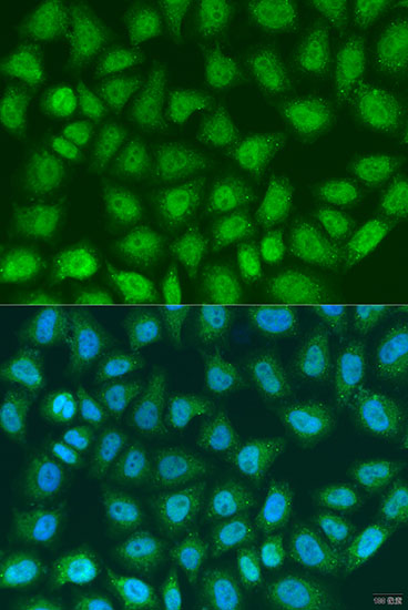 Immunofluorescence - SOCS4 Polyclonal Antibody 