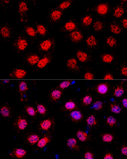 Immunofluorescence - CXCR4 Polyclonal Antibody 