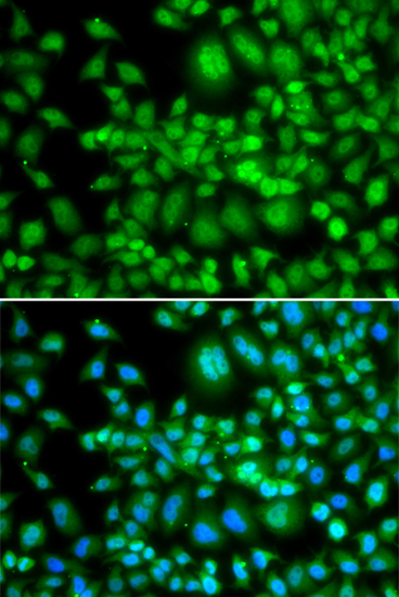 Immunofluorescence - SETD5 Polyclonal Antibody 