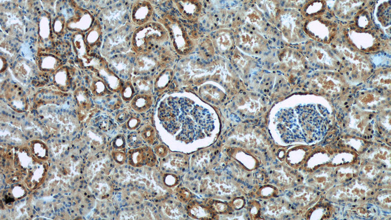 Immunohistochemistry of paraffin-embedded human kidney tissue slide using Catalog No:115963(HRD1 Antibody) at dilution of 1:50 (under 10x lens)