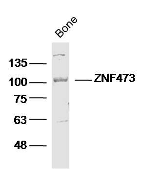 Fig1: Sample: Bone (mouse) Lysate at 40 ug; Primary: Anti- NF473 at 1/300 dilution; Secondary: IRDye800CW Goat Anti-Rabbit IgG at 1/20000 dilution; Predicted band size: 100 kD; Observed band size: 100 kD