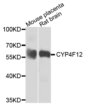 Western blot - CYP4F12 Polyclonal Antibody 