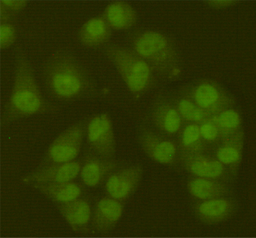 Immunofluorescent analysis of Hela cells fixed fixed by 4% paraformaldehyde and using SIRT6 mouse mAb (dilution 1:100).
