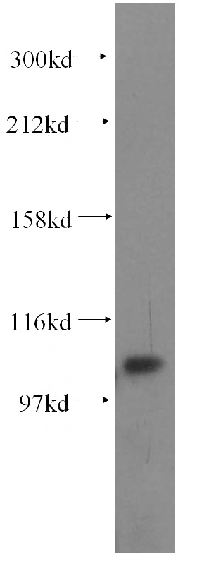 HEK-293 cells were subjected to SDS PAGE followed by western blot with Catalog No:111809(INTS7 antibody) at dilution of 1:500