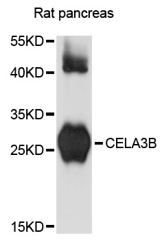 Western blot - CELA3B Polyclonal Antibody 