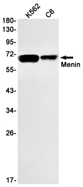Western blot detection of Menin in K562,C6 cell lysates using Menin Rabbit mAb(1:1000 diluted).Predicted band size:68kDa.Observed band size:68kDa.