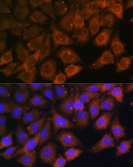 Immunofluorescence - MYO6 Polyclonal Antibody 