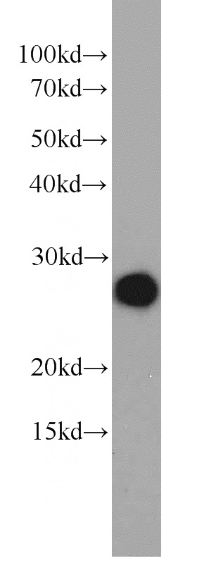A549 cells were subjected to SDS PAGE followed by western blot with Catalog No:113426(ORM2 antibody) at dilution of 1:800