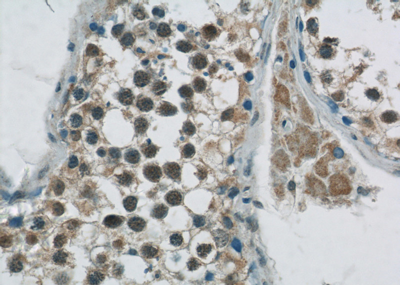 Immunohistochemistry of paraffin-embedded human testis tissue slide using Catalog No:110895(GBP6 Antibody) at dilution of 1:50 (under 40x lens)