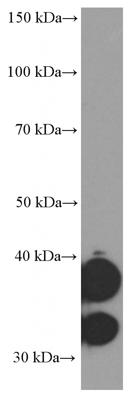 COLO 320 cells were subjected to SDS PAGE followed by western blot with Catalog No:107254(EPCAM Antibody) at dilution of 1:2000
