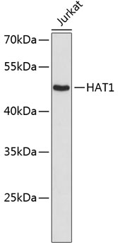 Western blot - HAT1 Polyclonal Antibody 