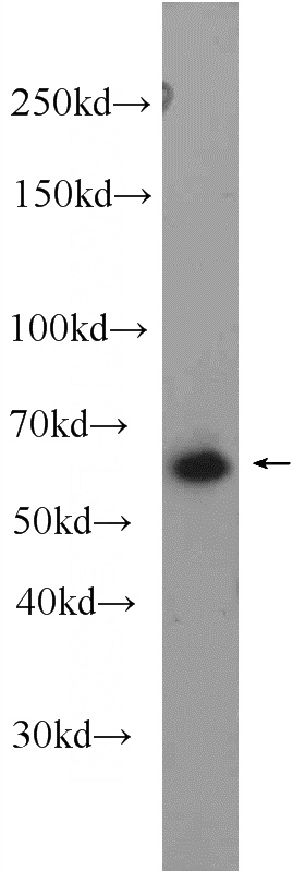 Y79 cells were subjected to SDS PAGE followed by western blot with Catalog No:111211(GRK1 Antibody) at dilution of 1:600