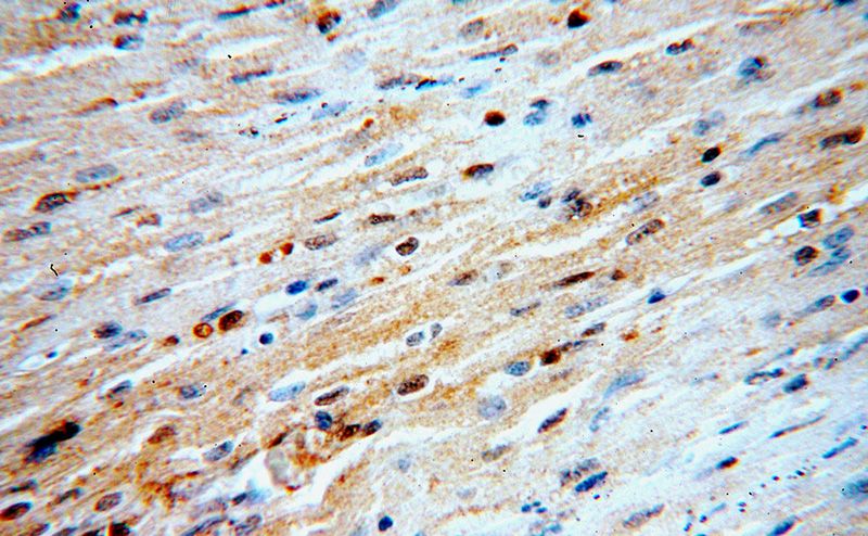 Immunohistochemical of paraffin-embedded human heart using Catalog No:112157(LATS2-Specific antibody) at dilution of 1:100 (under 40x lens)