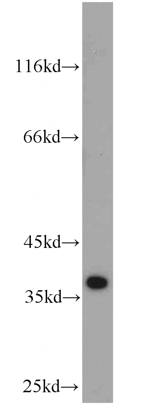 Jurkat cells were subjected to SDS PAGE followed by western blot with Catalog No:112602(MGME1 antibody) at dilution of 1:1000