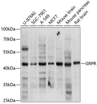 Western blot - GRPR Polyclonal Antibody 