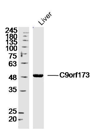 Fig1: Sample: Liver (Mouse)Lysate at 40 ug; Primary: Anti-C9orf173 at 1/300 dilution; Secondary: IRDye800CW Goat Anti-RabbitIgG at 1/20000 dilution; Predicted band size: 43kD; Observed band size: 48kD