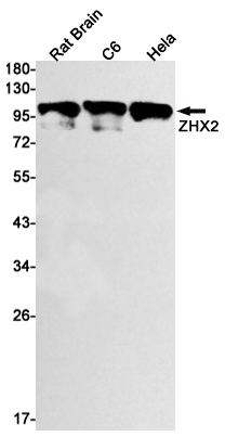 Western blot detection of ZHX2 in Rat Brain,C6,Hela cell lysates using ZHX2 Rabbit mAb(1:1000 diluted).Predicted band size:92kDa.Observed band size:110kDa.