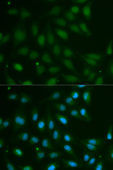 Immunofluorescence - ABO Polyclonal Antibody 