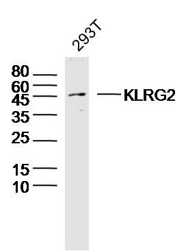 Fig1: Sample: 293T Cell (Human) Lysate at 40 ug; Primary: Anti- KLRG2 at 1/300 dilution; Secondary: IRDye800CW Goat Anti-Rabbit IgG at 1/20000 dilution; Predicted band size: 43 kD; Observed band size: 45 kD