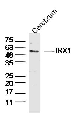 Fig1: Sample:Cerebrum (Mouse)Lysate at 40 ug; Primary: Anti-IRX1 at 1/300 dilution; Secondary: IRDye800CW Goat Anti-RabbitIgG at 1/20000 dilution; Predicted band size: 50kD; Observed band size: 50kD