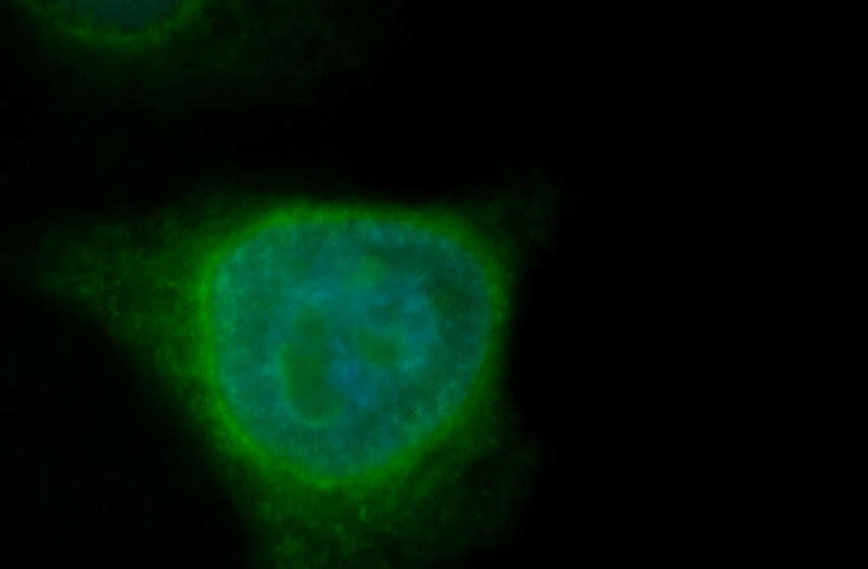 Immunofluorescent analysis of MCF-7 cells, using Catalog No:114079 and FITC-labeled donkey anti-rabbit IgG (green). Blue pseudocolor = DAPI (fluorescent DNA dye).