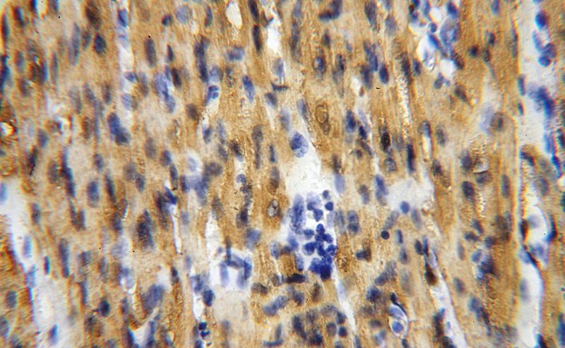 Immunohistochemical of paraffin-embedded human heart using Catalog No:112992(MB antibody) at dilution of 1:100 (under 40x lens)