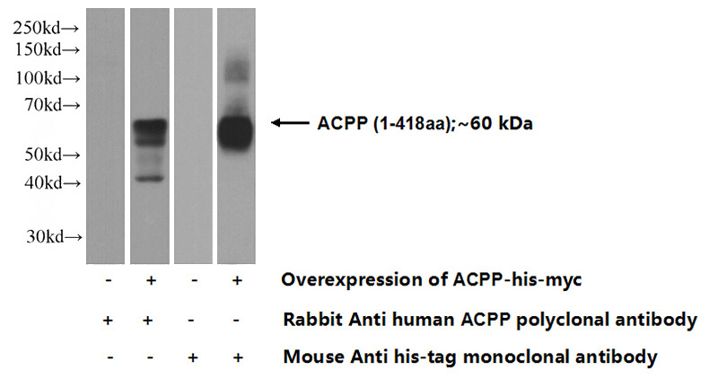 Transfected HEK-293 cells were subjected to SDS PAGE followed by western blot with Catalog No:107739(ACPP Antibody) at dilution of 1:2000
