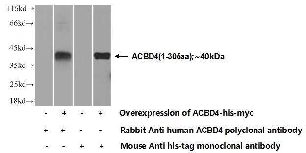 Transfected HEK-293 cells were subjected to SDS PAGE followed by western blot with Catalog No:107730(ACBD4 Antibody) at dilution of 1:700