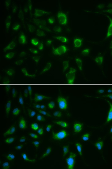 Immunofluorescence - TLR8 Polyclonal Antibody 