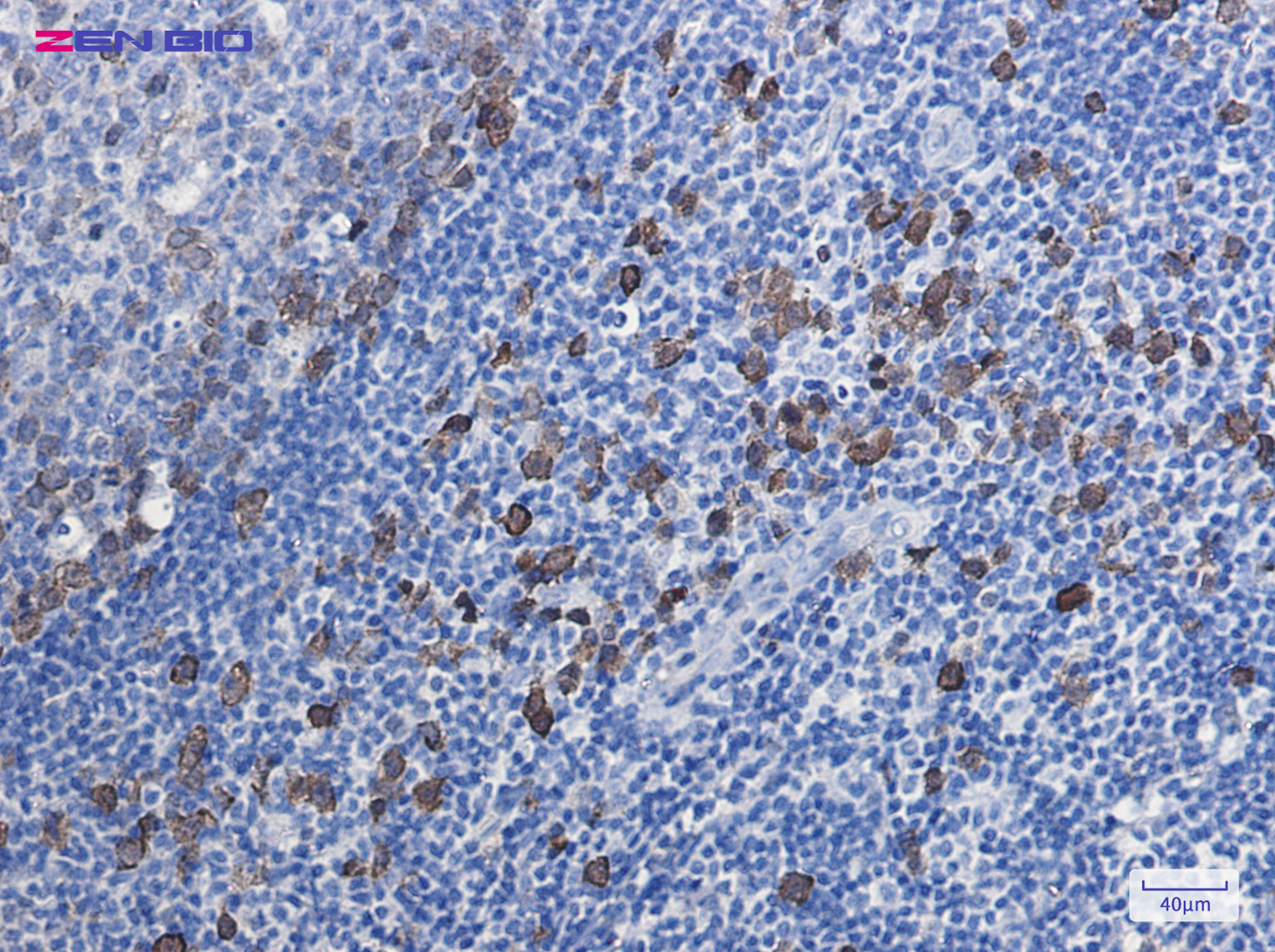 Immunohistochemistry of Thymidylate Synthase in paraffin-embedded Human tonsil using Thymidylate Synthase Rabbit pAb at dilution 1/20