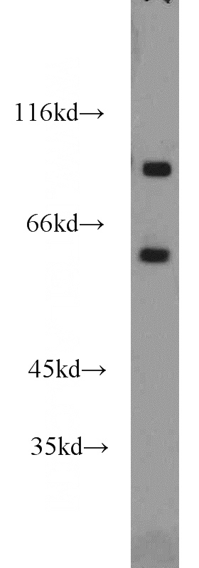 mouse brain tissue were subjected to SDS PAGE followed by western blot with Catalog No:110106(DNAJC16 antibody) at dilution of 1:1500