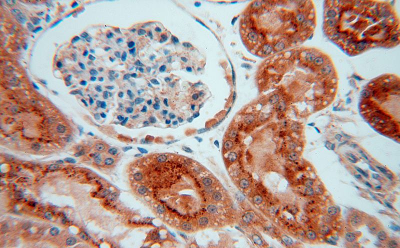 Immunohistochemical of paraffin-embedded human kidney using Catalog No:110845(GALNS antibody) at dilution of 1:50 (under 40x lens)