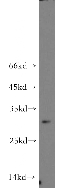 HL-60 cells were subjected to SDS PAGE followed by western blot with Catalog No:113122(NEURL2 antibody) at dilution of 1:500
