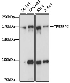 Western blot - TP53BP2 Polyclonal Antibody 