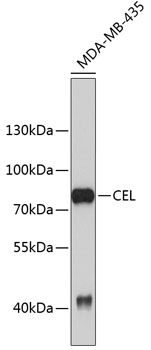 Western blot - CEL Polyclonal Antibody 