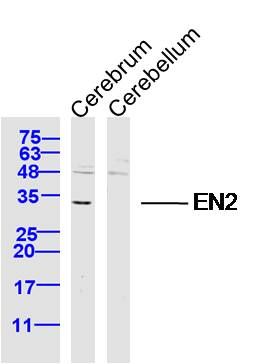 Fig1: Sample:; Cerebrum (Mouse) Lysate at 40 ug; Cerebellum (Mouse) Lysate at 40 ug; Primary: Anti-EN2 at 1/300 dilution; Secondary: IRDye800CW Goat Anti-Rabbit IgG at 1/20000 dilution; Predicted band size: 34 kD; Observed band size: 34 kD