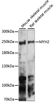 Western blot - MYH2 Polyclonal Antibody 