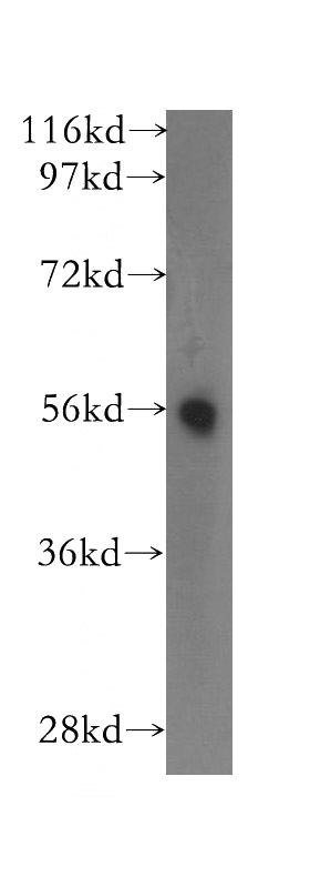 human lung tissue were subjected to SDS PAGE followed by western blot with Catalog No:116078(TM7SF2 antibody) at dilution of 1:400