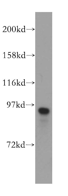 HEK-293 cells were subjected to SDS PAGE followed by western blot with Catalog No:111674(IFT88 antibody) at dilution of 1:1000