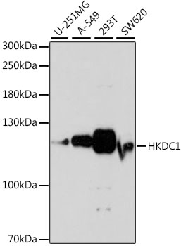 Western blot - HKDC1 Polyclonal Antibody 