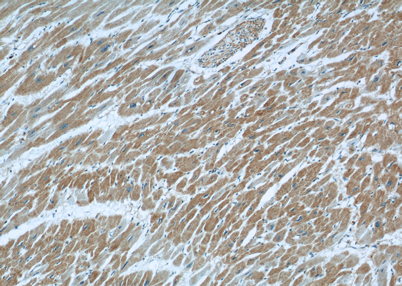 Immunohistochemical of paraffin-embedded human heart using Catalog No:112289(LNPEP antibody) at dilution of 1:50 (under 10x lens)