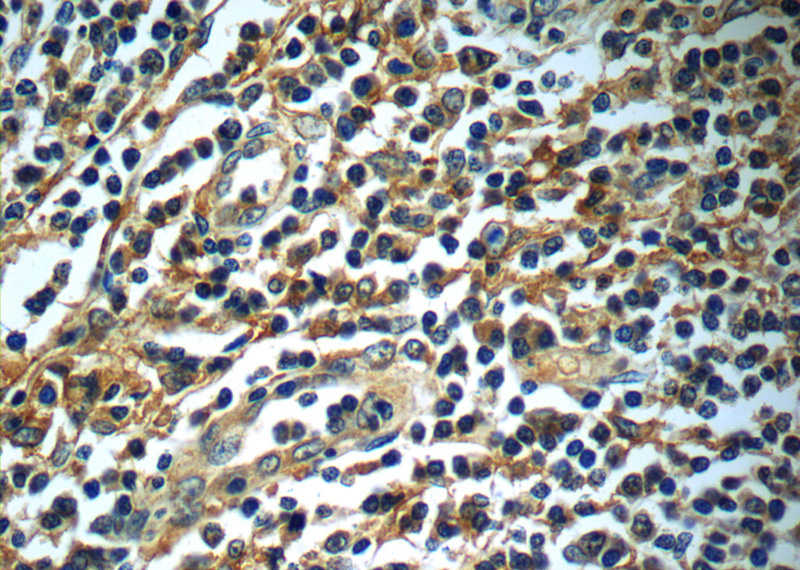 Immunohistochemistry of paraffin-embedded human tonsillitis slide using Catalog No:115226(SIGLEC7 Antibody) at dilution of 1:50