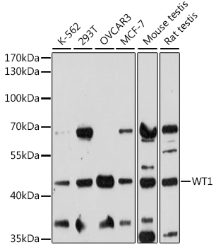 Western blot - WT1 Polyclonal Antibody 