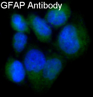 Immunofluorescent analysis of SNB19 cells, using GFAP Antibody.