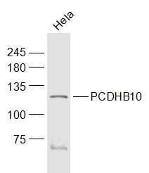 Fig5: Sample:; Hela(Human) Cell Lysate at 30 ug; Primary: Anti-PCDHB10 at 1/1000 dilution; Secondary: IRDye800CW Goat Anti-Rabbit IgG at 1/20000 dilution; Predicted band size: 84 kD; Observed band size: 112 kD