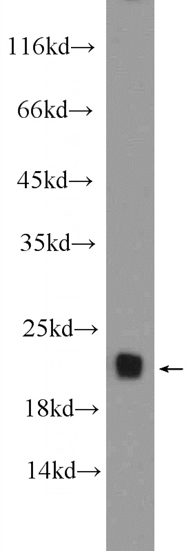 mouse brain tissue were subjected to SDS PAGE followed by western blot with Catalog No:108168(ARPC5 Antibody) at dilution of 1:600