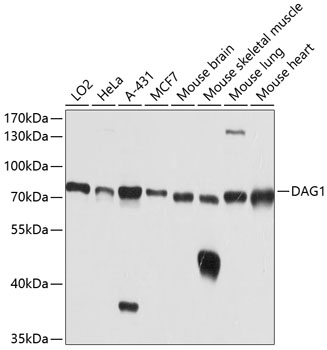 Western blot - DAG1 Polyclonal Antibody 