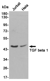 Western blot detection of TGF beta 1 in Jurkat and Hela cell lysates using TGF beta 1 rabbit pAb (1:1000 diluted).Predicted band size:44kDa.Observed band size:45~60kDa.