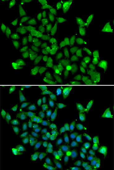 Immunofluorescence - ASPA Polyclonal Antibody 